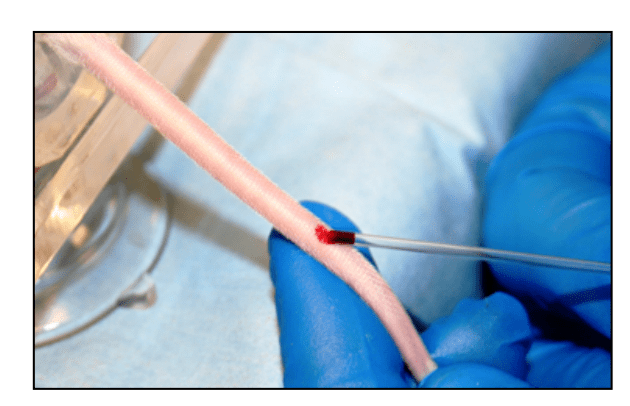 剪下几毫米小鼠尾巴;在小鼠尾静脉上划一道小口;或是用注射器抽取,来