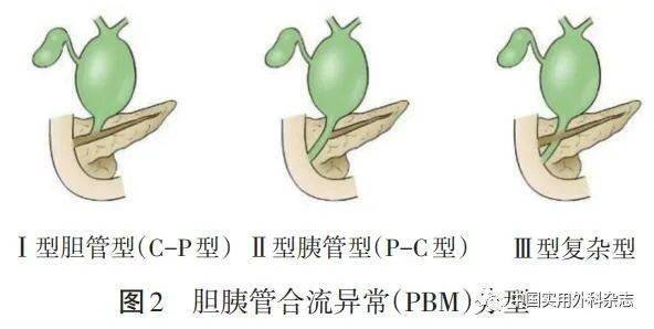 专题笔谈|从胆胰肠结合部解剖谈胆源性胰腺炎发生与防治