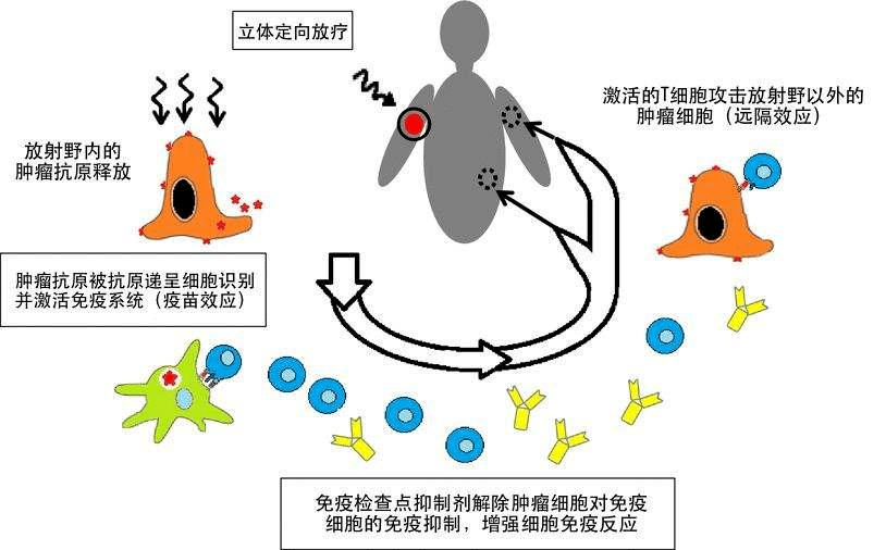 肺鳞癌3a期术后复发率_中期肺鳞癌能活多久_肺鳞癌中期平均生存期多久