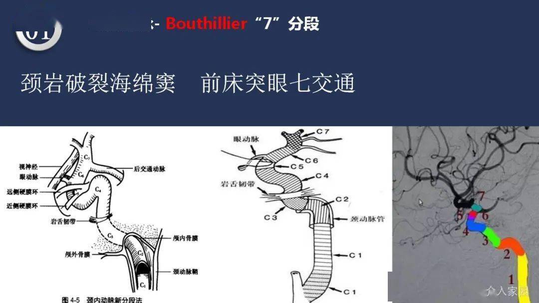 【深度学习】高清头颈动脉系统解剖_手机搜狐网