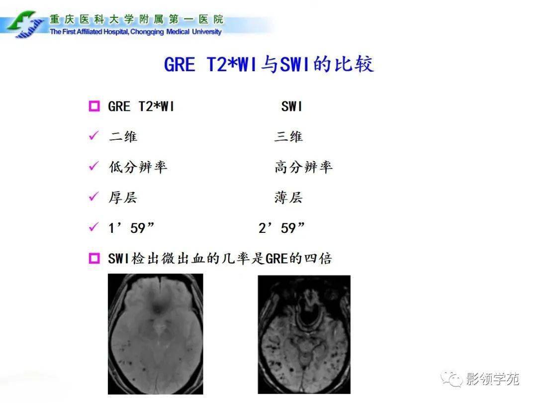 脑小血管病的影像学诊断