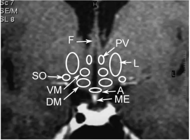 一圖讀懂下丘腦的解剖