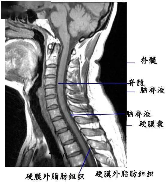 脊柱超详细解剖,高清图文版!_颈椎