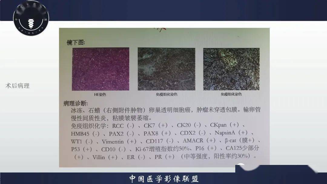 宫颈癌的哪8种症状表现今日金价_宫颈有炎症的症状表现_牙癌有什么症状表现