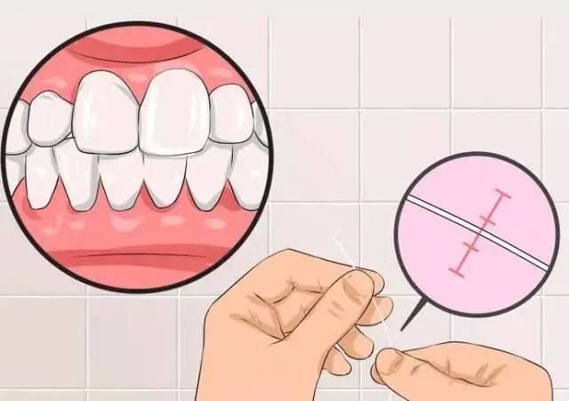 为什么你的牙缝越来越大赶紧看看你是不是做了这些事