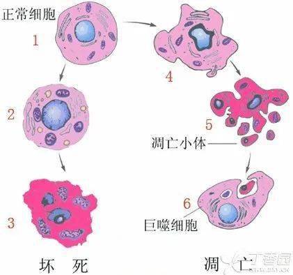 细胞凋亡和坏死的区别