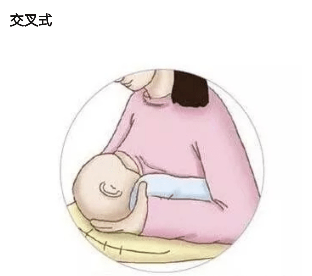 朱丹头胎生理性涨奶,r头皲裂,二胎还要坚持母乳喂养?