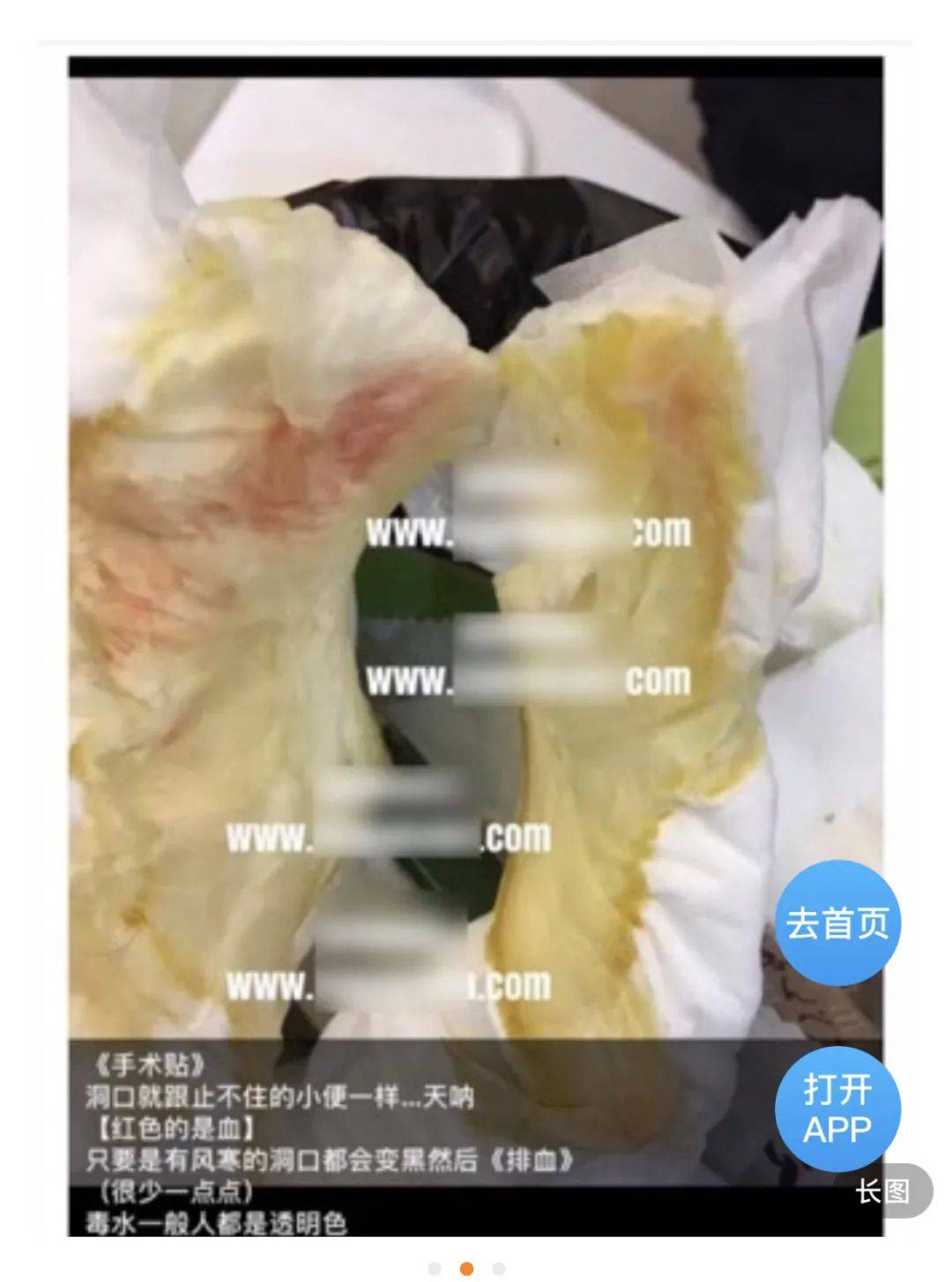 催吐减肥、断骨增高、换血美容，外貌焦虑下的伤害有多大？-搜狐大视野-搜狐新闻
