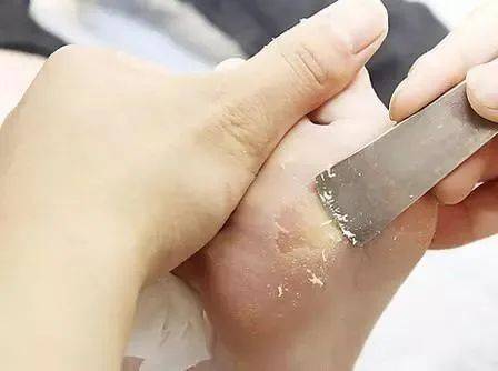 痛快"撕"脚皮,剥脱废弃角质,嫩肤滋养