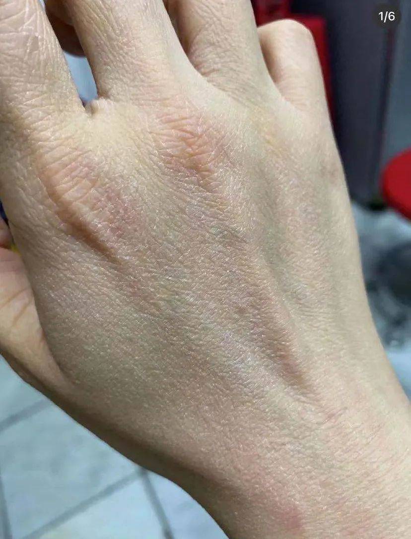 40岁还有纤纤少女手,秘诀竟然是.