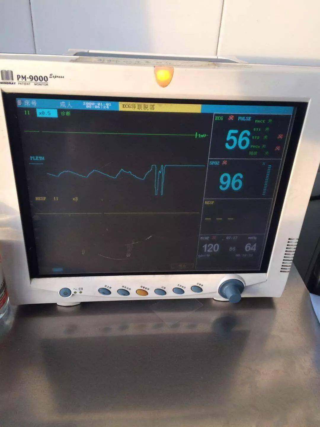 护理知识:心电监护仪天天用,这些问题你能答上来吗?