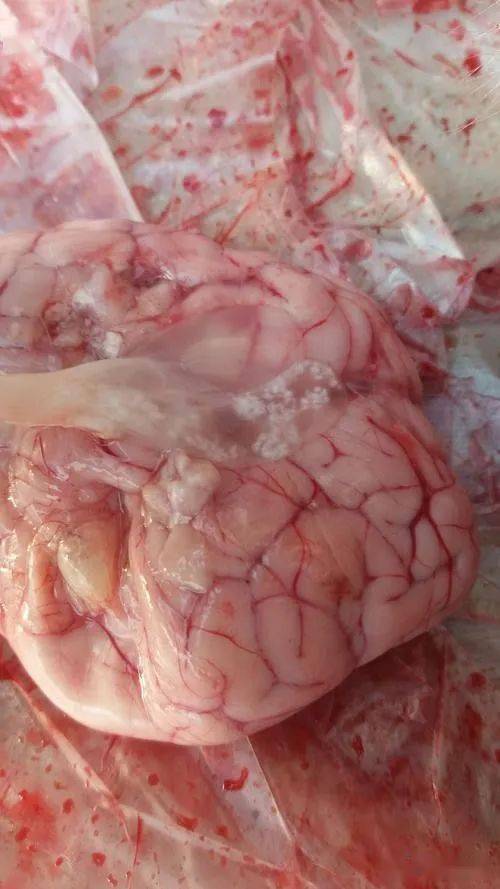 脑包虫手术图片