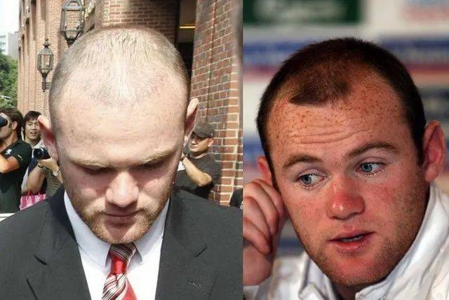 2017年,李开复还转发了马斯克的植发效果图,并感叹"这植发太厉害了".