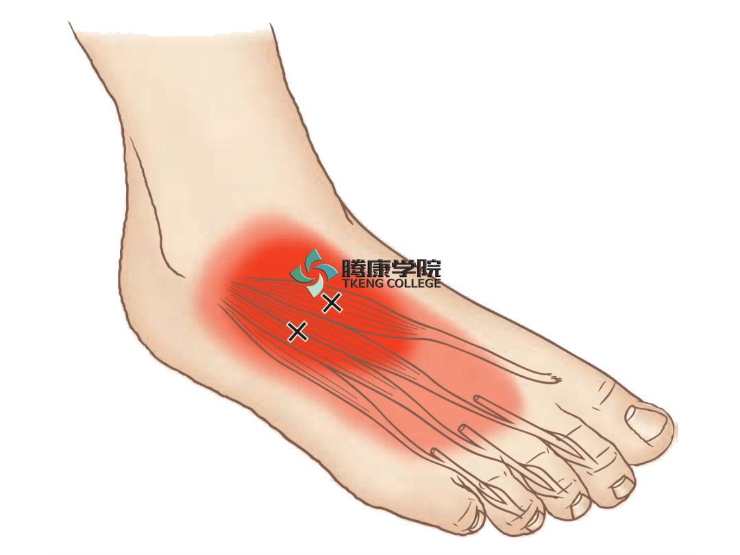 脚背位置图片大全图片