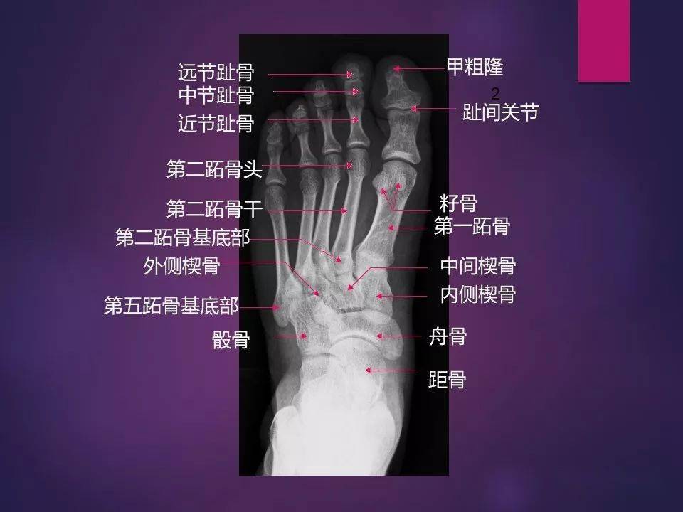 67经典不能错过骨肌系统影像解剖案前必备