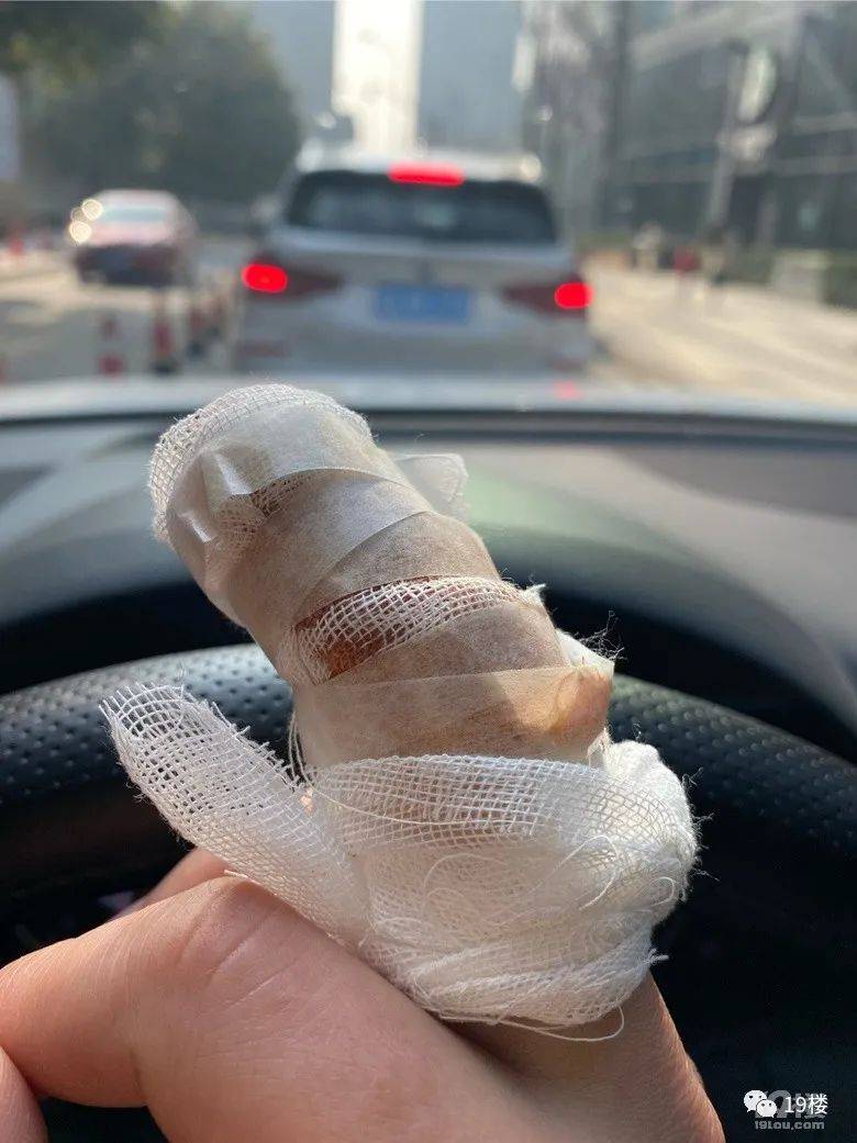 已注销此号:有可能是个年轻医生,我第一次给病人包扎的时候也特别