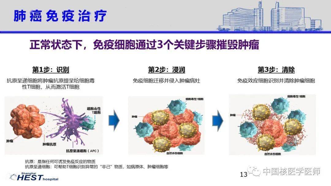 【核汇园】43期:谢文晖 | pet/ct在肺癌免疫治疗中应用