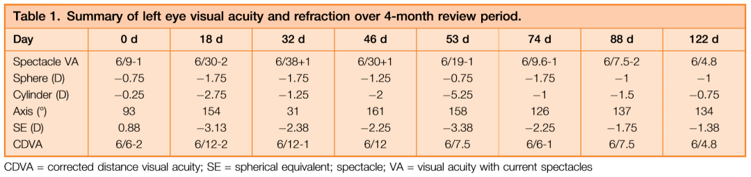 在治療過程中,患者左眼出現了顯著而頻繁的散光度數與軸位的波動(表1