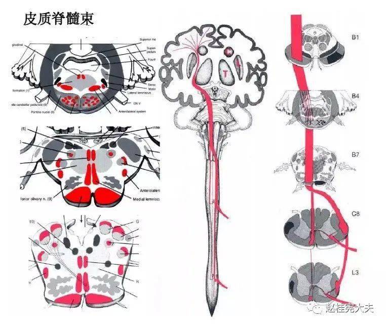 一例罕見的,以前未曾診斷過的長節段脊髓病變