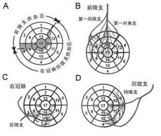 心脏磁共振成像中心肌节段如何划分