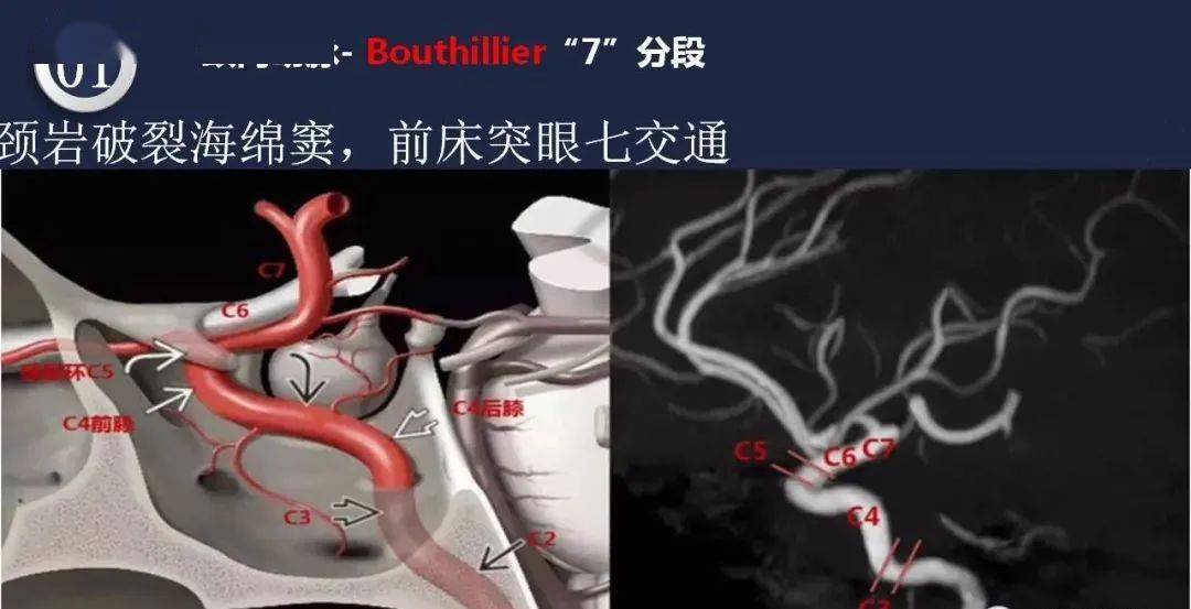 头颈动脉系统相关解剖