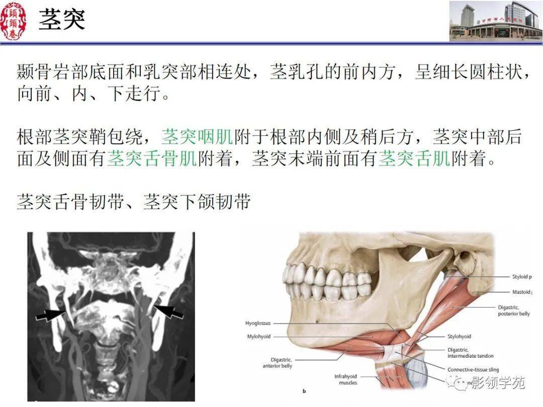 舌下伞襞正常图片图片