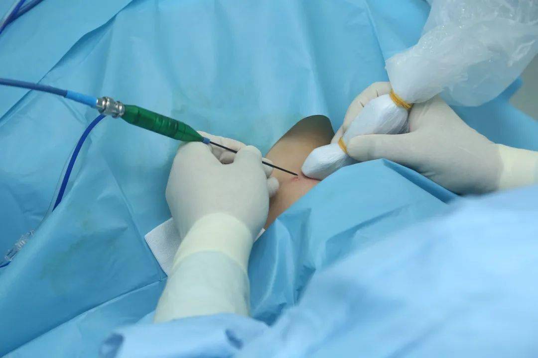 她的甲状腺癌在上海这家医院经微创治愈了