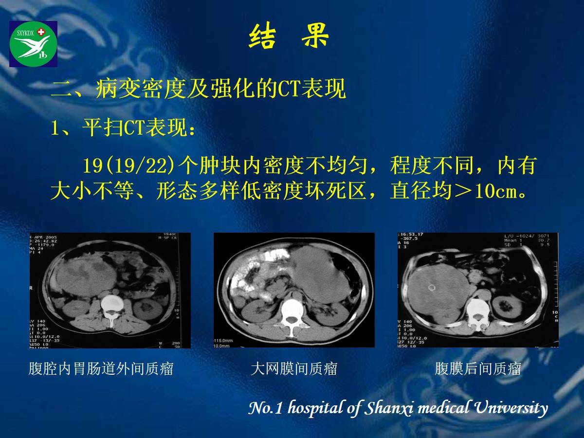 李健丁教授胃肠道外间质瘤的ct表现和临床病理分析