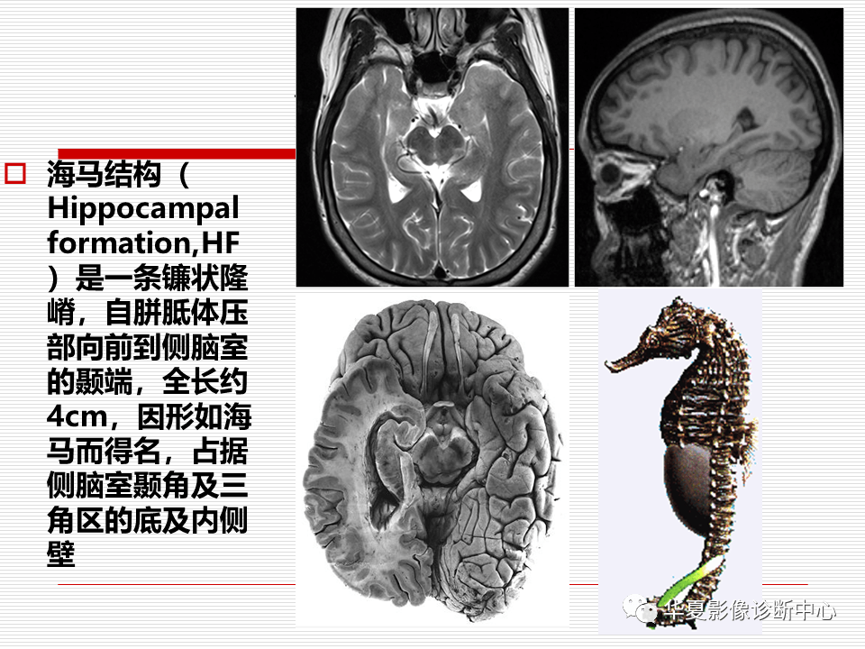 头颅海马的解剖结构图图片