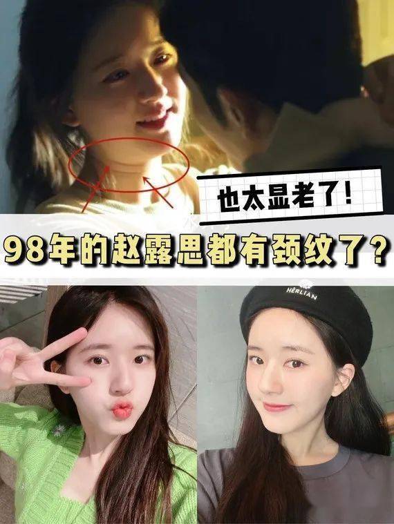 赵露思刘亦菲张嘉倪谁的颈纹更多更明显?_脖子