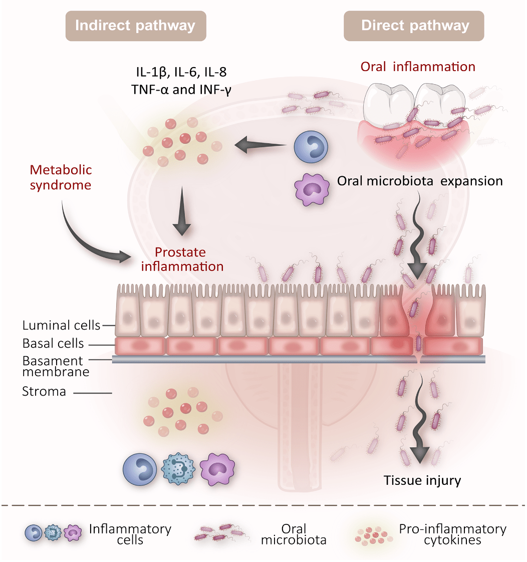 9分综述口腔菌群怎样与前列腺疾病发生关系微生物专题