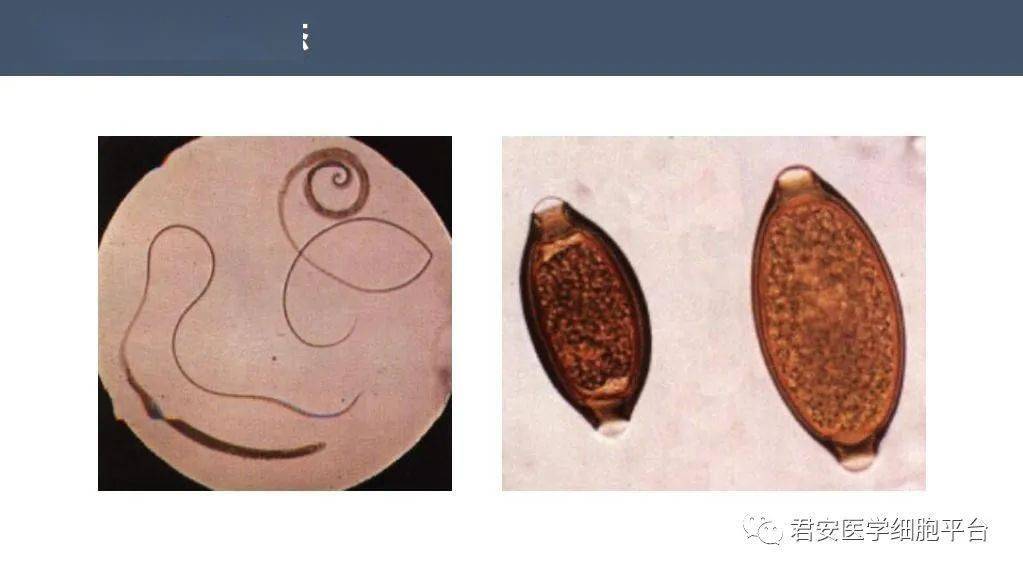 鞭虫卵结构示意图图片