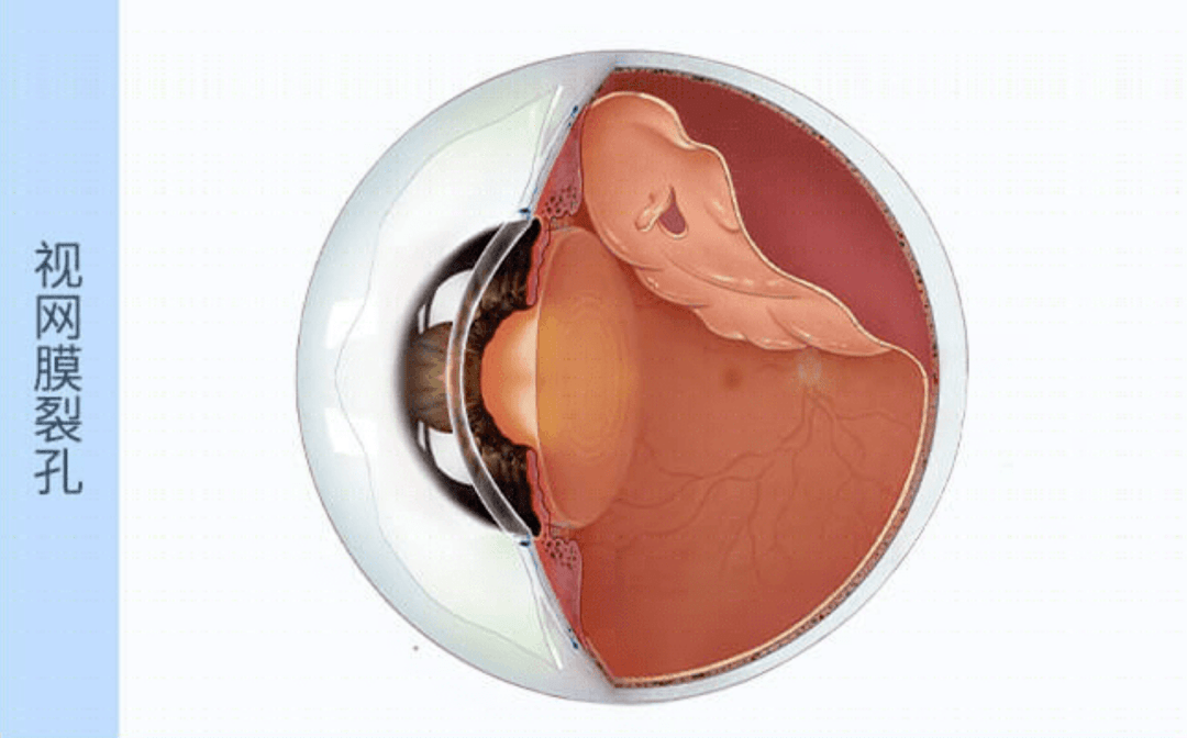 这个坏习惯你也有……_视网膜
