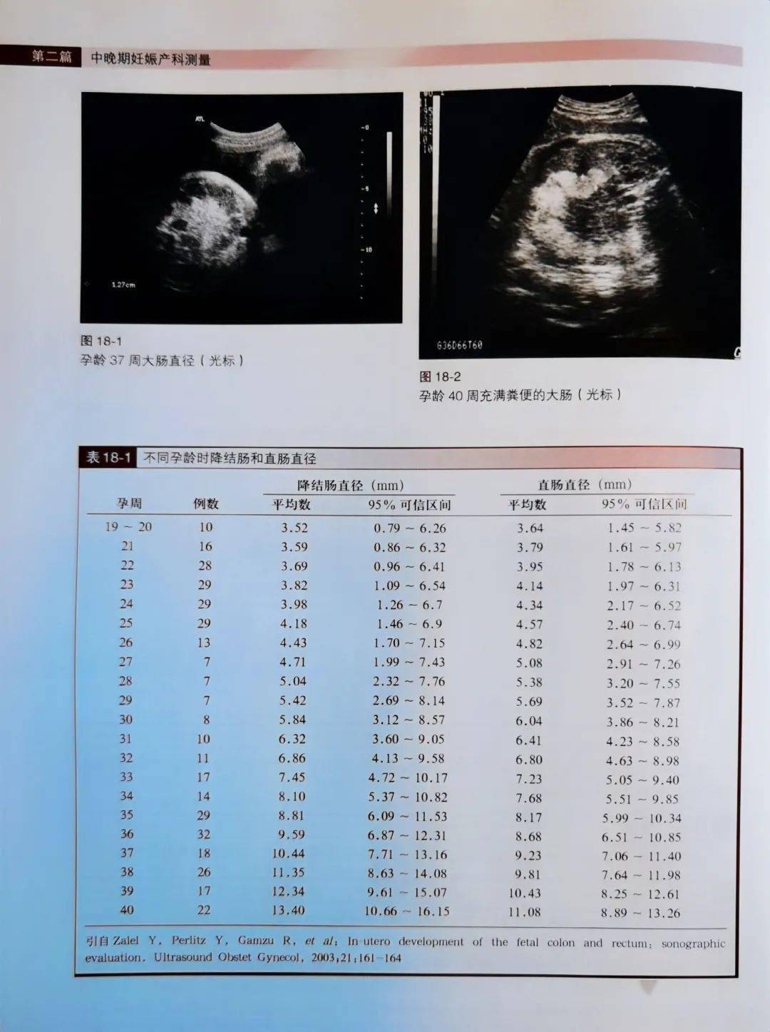 談談胎兒腸管正常值