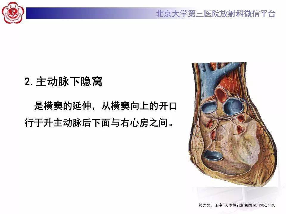 心包窦及心包隐窝解剖