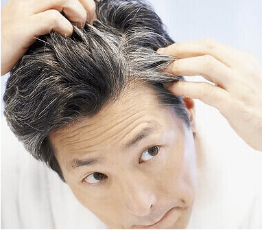 女人多少岁开始长白头发正常 d98624426ae441a9ba45a8ff4309f795.png