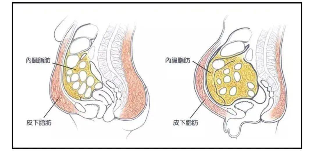 肚子脂肪怎么看 0d3f9e6de2ac465fab1000e3918561d0.jpeg