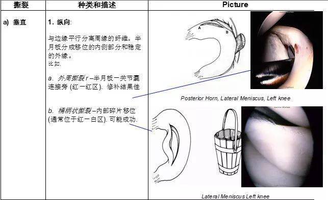 阳病治阴利用什么原理_阴疽是什么病(3)