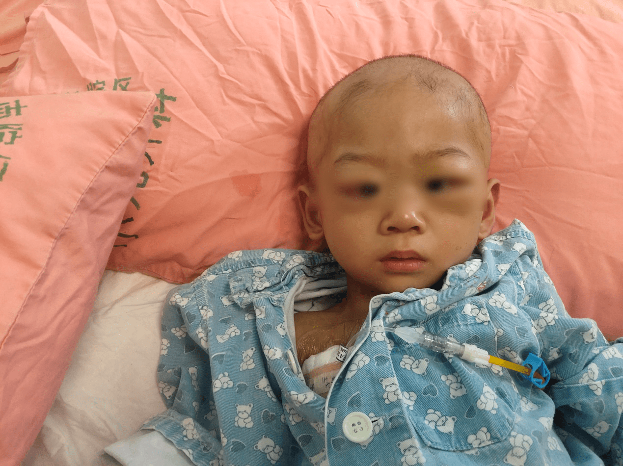 2岁娃染恶疾近乎失明,母亲身兼数职日劳作20小时挣钱救子