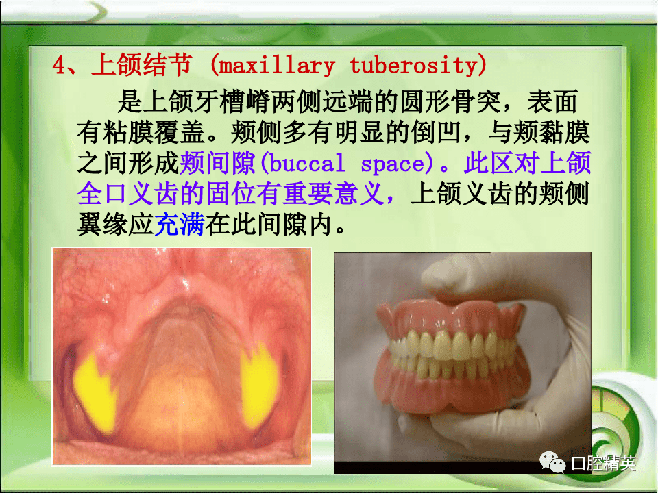 全口无牙颌解剖标志识别
