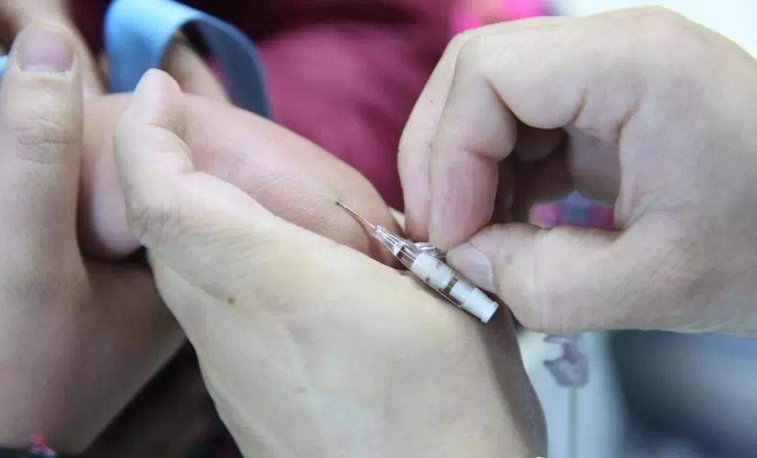 留置针穿刺新技能单手送管法提高成功率你get了吗