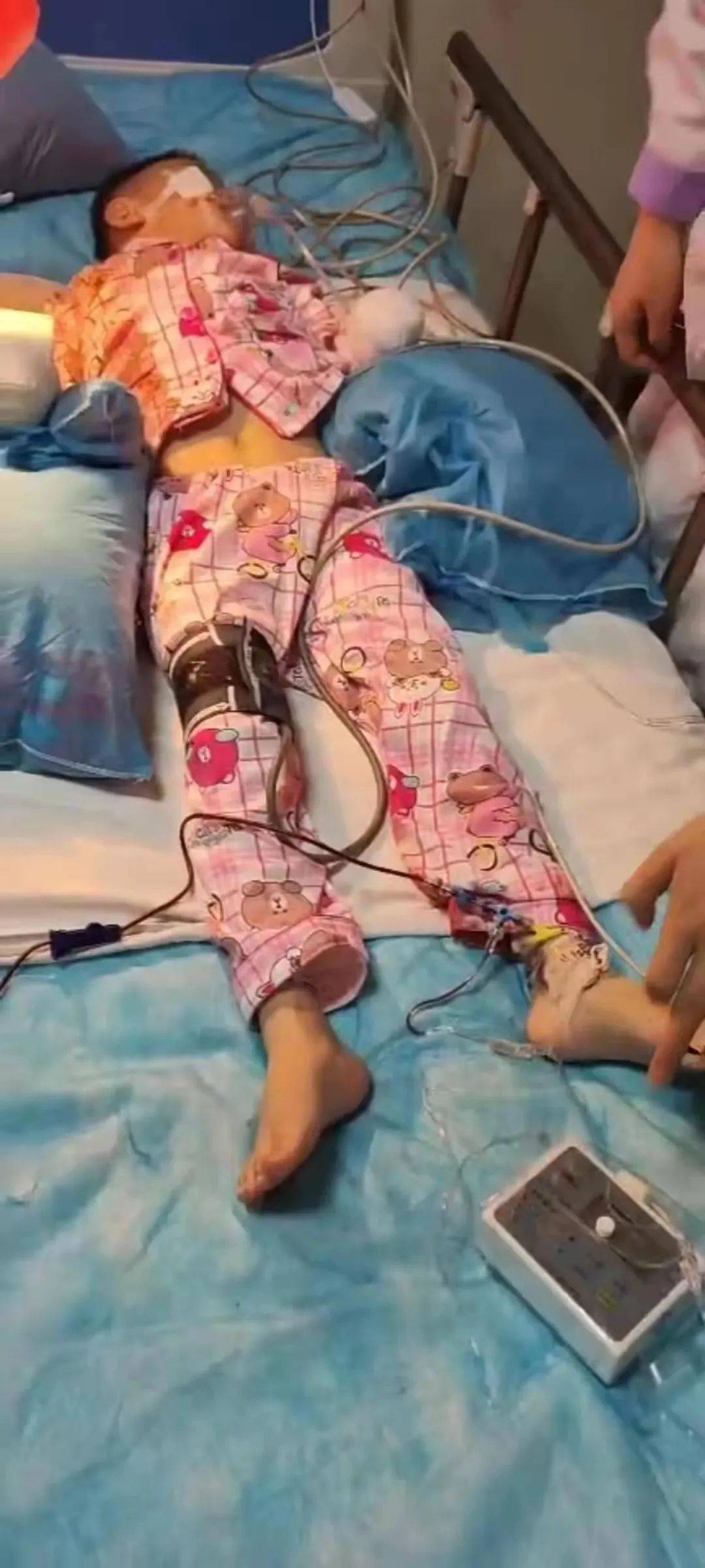 可怜!青海 西宁6岁男童双手被炸