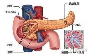 (二),胰腺及胰周组织坏死指胰腺实质的弥漫性或局灶性坏死,伴有胰周