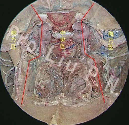 側顱底頸靜脈孔專題一鮑遇海夏寅劉丕楠汪照炎張明山