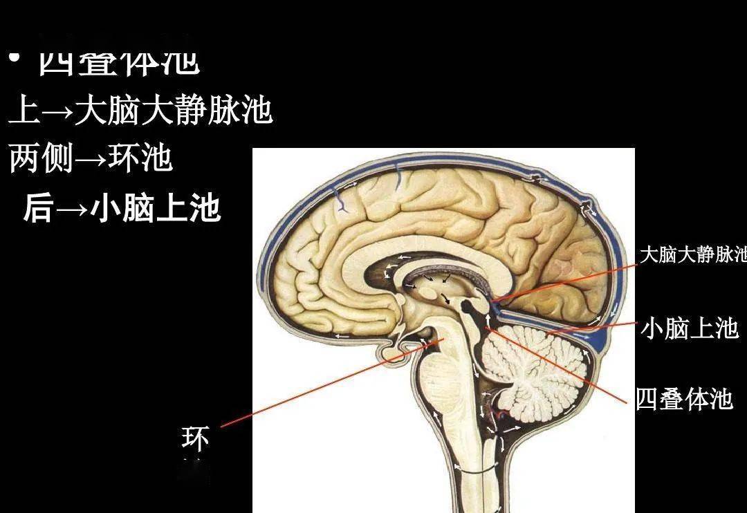 高清解剖脑室脑池脑膜