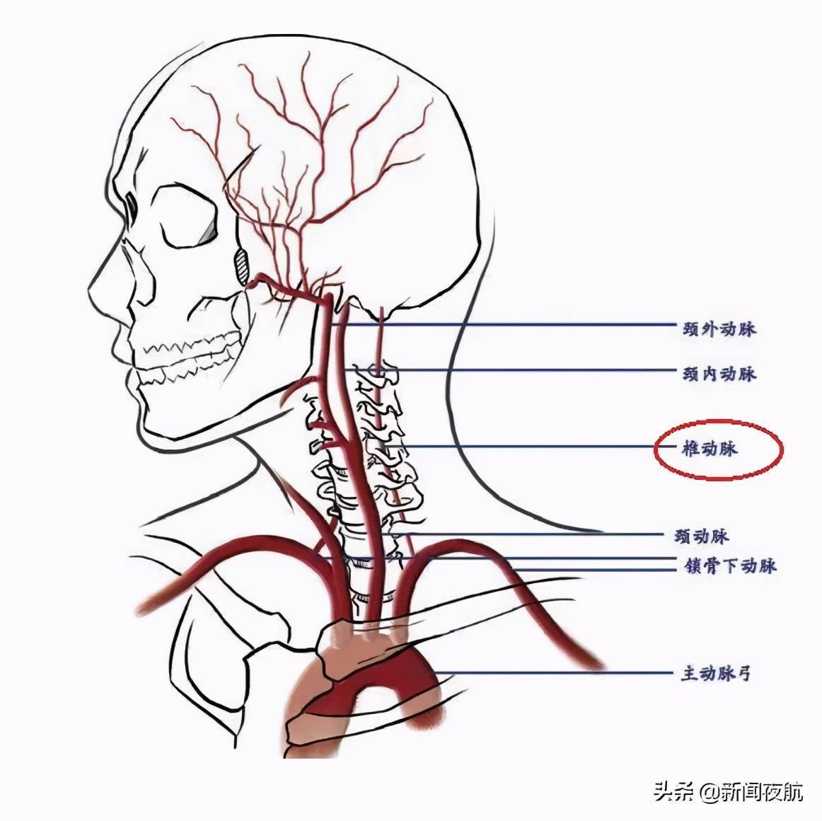 脑梗死位置图图片