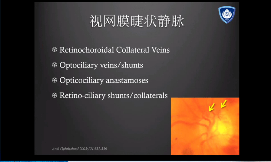 比較無視網膜睫狀動脈的crao好來自睫狀後動脈,位於視盤顳側伴隨網膜