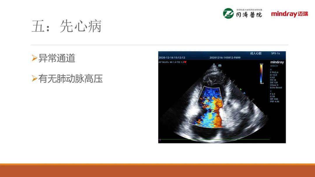 武汉同济医院麻醉科围术期经胸超声心动图tte