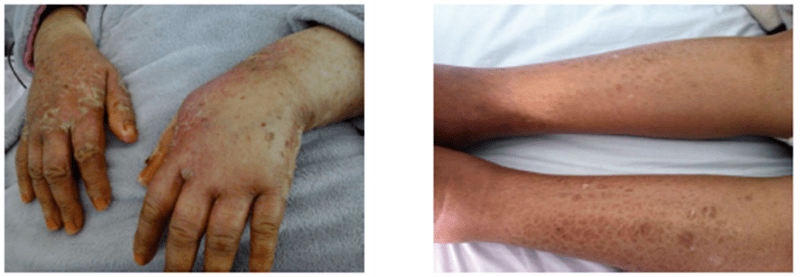 多西他赛注射液质量与疗效评价标准的几点考量