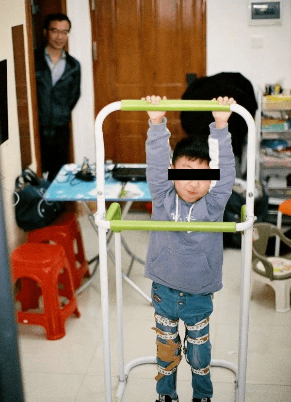 有一种无力叫sma脊髓性肌肉萎缩症